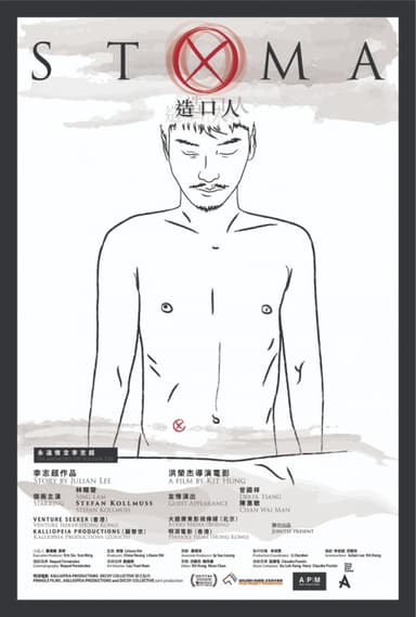 Stoma
